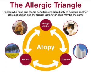 allergic-triangle
