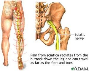 sciatic-nerve.300x240