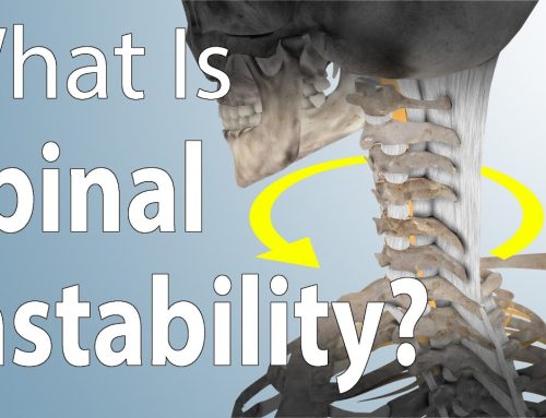 A stiff inflexible back and body