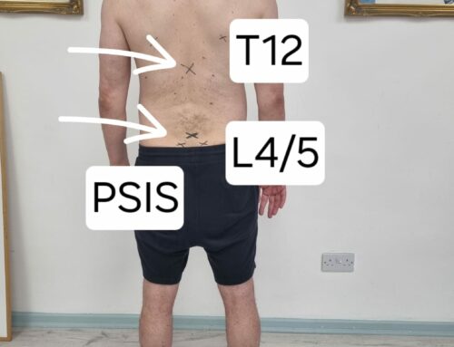 Are assessments important for chronic back pain?