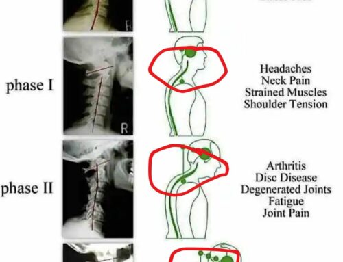 “Arm Pain? Your Neck Might Be the Real Culprit!”